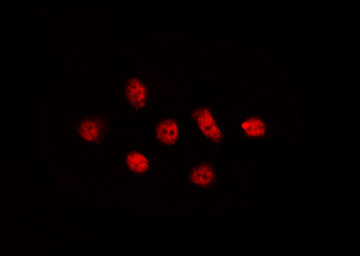 CLK4 Antibody - Staining LOVO cells by IF/ICC. The samples were fixed with PFA and permeabilized in 0.1% Triton X-100, then blocked in 10% serum for 45 min at 25°C. The primary antibody was diluted at 1:200 and incubated with the sample for 1 hour at 37°C. An Alexa Fluor 594 conjugated goat anti-rabbit IgG (H+L) Ab, diluted at 1/600, was used as the secondary antibody.
