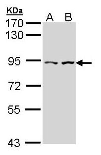 CLLP / CTNNAL1 Antibody - Sample (30 ug of whole cell lysate). A: Hela, B: Hep G2 . 7.5% SDS PAGE. CLLP / CTNNAL1 antibody diluted at 1:1000.