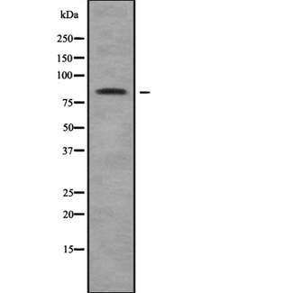 CLLP / CTNNAL1 Antibody - Western blot analysis of CTNNAL1 using HuvEc whole cells lysates