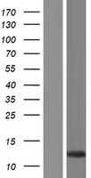 CLLU1OS Protein - Western validation with an anti-DDK antibody * L: Control HEK293 lysate R: Over-expression lysate