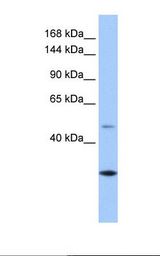 CLMN Antibody - Fetal liver lysate. Antibody concentration: 1.0 ug/ml. Gel concentration: 6-18%.  This image was taken for the unconjugated form of this product. Other forms have not been tested.