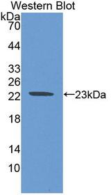 CLMP / ACAM Antibody - Western blot of CLMP / ACAM antibody.