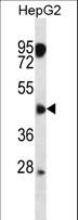 CLMP / ACAM Antibody - ASAM Antibody western blot of HepG2 cell line lysates (35 ug/lane). The ASAM antibody detected the ASAM protein (arrow).