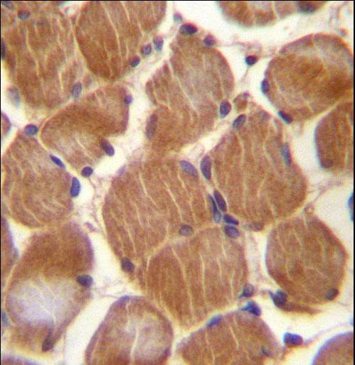 CLMP / ACAM Antibody - ASAM Antibody immunohistochemistry of formalin-fixed and paraffin-embedded human skeletal muscle followed by peroxidase-conjugated secondary antibody and DAB staining.