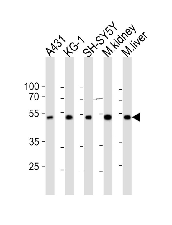 CLN3 Antibody - Western blot of lysates from A431, KG-1, SH-SY5Y cell line, mouse kidney, mouse liver tissue (from left to right) with CLN3 Antibody. Antibody was diluted at 1:1000 at each lane. A goat anti-rabbit IgG H&L (HRP) at 1:10000 dilution was used as the secondary antibody. Lysates at 20 ug per lane.
