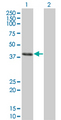 CLN3 Antibody - Western Blot analysis of CLN3 expression in transfected 293T cell line by CLN3 monoclonal antibody (M03), clone 1G10.Lane 1: CLN3 transfected lysate(47.623 KDa).Lane 2: Non-transfected lysate.
