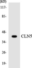 CLN5 Antibody - Western blot analysis of the lysates from COLO205 cells using CLN5 antibody.