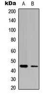 CLN5 Antibody - Western blot analysis of CLN5 expression in HEK293T (A); NIH3T3 (B) whole cell lysates.