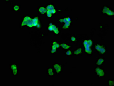 CLN5 Antibody - Immunofluorescence staining of 293T cells at a dilution of 1:100, counter-stained with DAPI. The cells were fixed in 4% formaldehyde, permeabilized using 0.2% Triton X-100 and blocked in 10% normal Goat Serum. The cells were then incubated with the antibody overnight at 4 °C.The secondary antibody was Alexa Fluor 488-congugated AffiniPure Goat Anti-Rabbit IgG (H+L) .