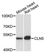 CLN5 Antibody - Western blot analysis of extracts of various cell lines, using CLN5 antibody at 1:3000 dilution. The secondary antibody used was an HRP Goat Anti-Rabbit IgG (H+L) at 1:10000 dilution. Lysates were loaded 25ug per lane and 3% nonfat dry milk in TBST was used for blocking. An ECL Kit was used for detection and the exposure time was 90s.