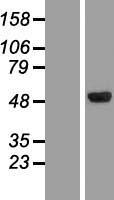 CLN5 Protein - Western validation with an anti-DDK antibody * L: Control HEK293 lysate R: Over-expression lysate