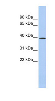 CLN6 Antibody - CLN6 antibody Western blot of Fetal Lung lysate. This image was taken for the unconjugated form of this product. Other forms have not been tested.