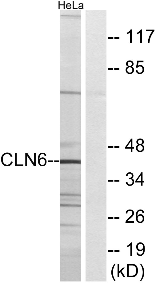 CLN6 Antibody - Western blot analysis of lysates from HeLa cells, using CLN6 Antibody. The lane on the right is blocked with the synthesized peptide.