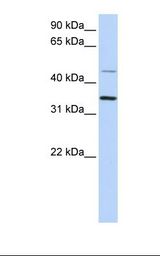 CLN6 Antibody - 293T cell lysate. Antibody concentration: 1.0 ug/ml. Gel concentration: 12%.  This image was taken for the unconjugated form of this product. Other forms have not been tested.
