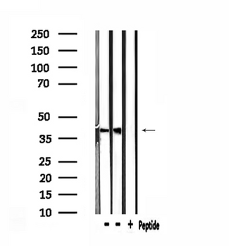 CLN6 Antibody - Western blot analysis of extracts of mouse brain and 293 cells using CLN6 antibody.