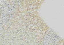 CLN6 Antibody - 1:100 staining mouse liver tissue by IHC-P. The sample was formaldehyde fixed and a heat mediated antigen retrieval step in citrate buffer was performed. The sample was then blocked and incubated with the antibody for 1.5 hours at 22°C. An HRP conjugated goat anti-rabbit antibody was used as the secondary.