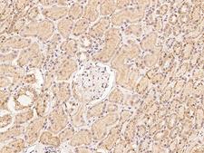 CLN6 Antibody - Immunochemical staining of human CLN6 in human kidney with rabbit polyclonal antibody at 1:100 dilution, formalin-fixed paraffin embedded sections.