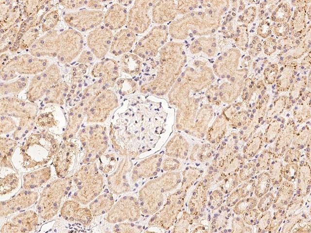 CLN6 Antibody - Immunochemical staining of human CLN6 in human kidney with rabbit polyclonal antibody at 1:100 dilution, formalin-fixed paraffin embedded sections.