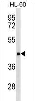 CLN8 Antibody - CLN8 Antibody western blot of HL-60 cell line lysates (35 ug/lane). The CLN8 antibody detected the CLN8 protein (arrow).
