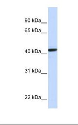 CLN8 Antibody - Hela cell lysate. Antibody concentration: 1.0 ug/ml. Gel concentration: 12%.  This image was taken for the unconjugated form of this product. Other forms have not been tested.