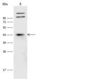 CLN8 Antibody - Anti-CLN8 rabbit polyclonal antibody at 1:500 dilution. Lane A: HeLa Whole Cell Lysate. Lysates/proteins at 30 ug per lane. Secondary: Goat Anti-Rabbit IgG (H+L)/HRP at 1/10000 dilution. Developed using the ECL technique. Performed under reducing conditions. Predicted band size: 33 kDa. Observed band size: 43 kDa. (We are unsure as to the identity of these extra bands.)