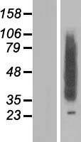 CLN8 Protein - Western validation with an anti-DDK antibody * L: Control HEK293 lysate R: Over-expression lysate