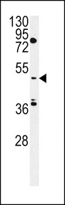 CLNK Antibody - MIST Antibody western blot of HepG2 cell line lysates (35 ug/lane). The MIST antibody detected the MIST protein (arrow).