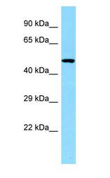 CLNK Antibody - CLNK antibody Western Blot of Fetal Heart.  This image was taken for the unconjugated form of this product. Other forms have not been tested.