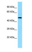 CLNK Antibody - CLNK antibody Western Blot of Fetal Heart.  This image was taken for the unconjugated form of this product. Other forms have not been tested.