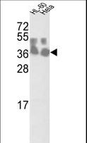 CLNS1A Antibody - Western blot of CLNS1A Antibody in HL-60 and HeLa cell line lysates (35 ug/lane). CLNS1A (arrow) was detected using the purified antibody.