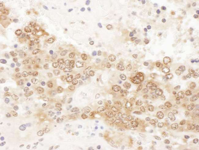 CLNS1A Antibody - Detection of mouse ICLN by immunohistochemistry. Sample: FFPE section of mouse teratoma. Antibody: Affinity purified rabbit anti- ICLN used at a dilution of 1:1,000 (1µg/ml). Detection: DAB