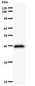 CLNS1A Antibody - Western blot of immunized recombinant protein using CLNS1A antibody.