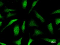 CLNS1A Antibody - Immunostaining analysis in HeLa cells. HeLa cells were fixed with 4% paraformaldehyde and permeabilized with 0.1% Triton X-100 in PBS. The cells were immunostained with anti-CLNS1A mAb.
