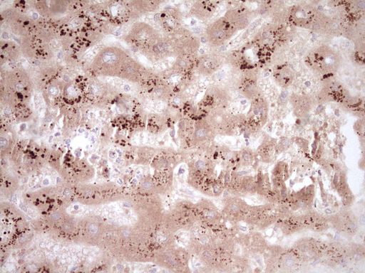 CLOCK Antibody - Immunohistochemical staining of paraffin-embedded Human liver tissue within the normal limits using anti-CLOCK mouse monoclonal antibody. (Heat-induced epitope retrieval by 1 mM EDTA in 10mM Tris, pH8.5, 120C for 3min,