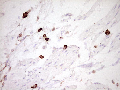 CLOCK Antibody - Immunohistochemical staining of paraffin-embedded Human bladder tissue within the normal limits using anti-CLOCK mouse monoclonal antibody. (Heat-induced epitope retrieval by 1 mM EDTA in 10mM Tris, pH8.5, 120C for 3min,