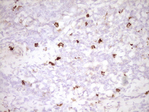 CLOCK Antibody - Immunohistochemical staining of paraffin-embedded Human tonsil within the normal limits using anti-CLOCK mouse monoclonal antibody. (Heat-induced epitope retrieval by 1 mM EDTA in 10mM Tris, pH8.5, 120C for 3min,