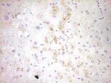 CLOCK Antibody - Immunohistochemical staining of paraffin-embedded Human liver tissue within the normal limits using anti-CLOCK mouse monoclonal antibody. (Heat-induced epitope retrieval by 1 mM EDTA in 10mM Tris, pH8.5, 120C for 3min,