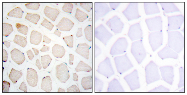 CLOCK Antibody - Immunohistochemistry analysis of paraffin-embedded human skeletal muscle tissue, using Clock Antibody. The picture on the right is blocked with the synthesized peptide.