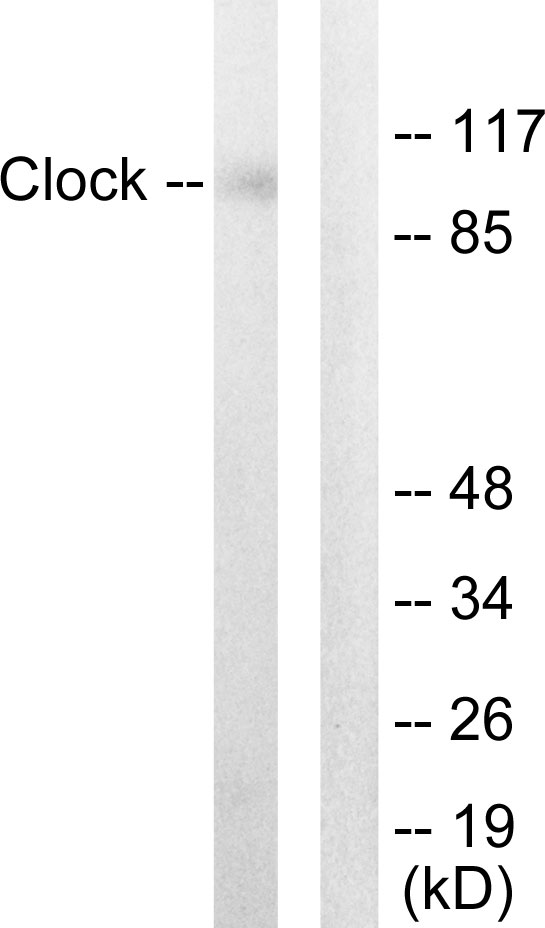 CLOCK Antibody - Western blot analysis of lysates from HUVEC cells, using Clock Antibody. The lane on the right is blocked with the synthesized peptide.
