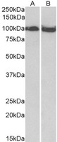 CLOCK Antibody - CLOCK antibody (0.03 ug/ml) staining of Mouse (A) and Rat (B) Skeletal Muscle lysate (35 ug protein in RIPA buffer). Primary incubation was 1 hour. Detected by chemiluminescence.