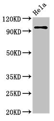 CLOCK Antibody - Western Blot Positive WB detected in:Hela whole cell lysate All Lanes:CLOCK antibody at 3.5µg/ml Secondary Goat polyclonal to rabbit IgG at 1/50000 dilution Predicted band size: 96 KDa Observed band size: 96 KDa