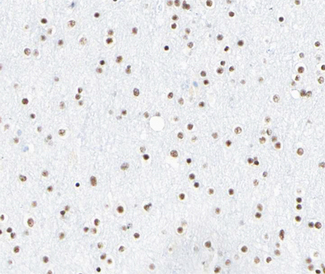 CLOCK Antibody - 1:100 staining human brain tissue by IHC-P. The tissue was formaldehyde fixed and a heat mediated antigen retrieval step in citrate buffer was performed. The tissue was then blocked and incubated with the antibody for 1.5 hours at 22°C. An HRP conjugated goat anti-rabbit antibody was used as the secondary.