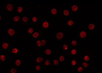 CLOCK Antibody - Staining HuvEc cells by IF/ICC. The samples were fixed with PFA and permeabilized in 0.1% Triton X-100, then blocked in 10% serum for 45 min at 25°C. The primary antibody was diluted at 1:200 and incubated with the sample for 1 hour at 37°C. An Alexa Fluor 594 conjugated goat anti-rabbit IgG (H+L) Ab, diluted at 1/600, was used as the secondary antibody.