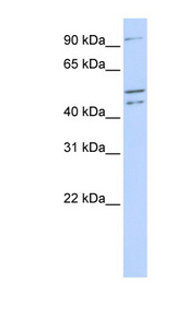 CLOCK Antibody - CLOCK antibody Western blot of 721_B cell lysate. This image was taken for the unconjugated form of this product. Other forms have not been tested.