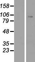 CLOCK Protein - Western validation with an anti-DDK antibody * L: Control HEK293 lysate R: Over-expression lysate