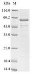 botD Protein - (Tris-Glycine gel) Discontinuous SDS-PAGE (reduced) with 5% enrichment gel and 15% separation gel.