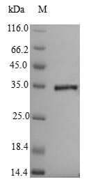 Penicillin-binding protein 1A Protein - (Tris-Glycine gel) Discontinuous SDS-PAGE (reduced) with 5% enrichment gel and 15% separation gel.