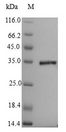 Penicillin-binding protein 1A Protein - (Tris-Glycine gel) Discontinuous SDS-PAGE (reduced) with 5% enrichment gel and 15% separation gel.
