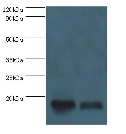 CLP / COTL1 Antibody - Western blot. All lanes: COTL1 antibody at 5 ug/ml. Lane 1: mouse brain tissue. Lane 2: mouse kidney tissue. Secondary antibody: Goat polyclonal to rabbit at 1:10000 dilution. Predicted band size: 16 kDa. Observed band size: 16 kDa.