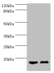 CLP / COTL1 Antibody - Western blot All lanes: COTL1 antibody at 5µg/ml Lane 1: Mouse brain tissue Lane 2: Mouse kidney tissue Secondary Goat polyclonal to rabbit IgG at 1/10000 dilution Predicted band size: 16 kDa Observed band size: 16 kDa